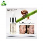 سرم حلزون لانبنا